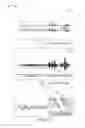 Fig. 04 - Determining digit movement from frequency data