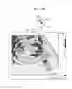 Fig. 45 - Method and ultrasound apparatus for displaying an object