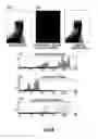 Fig. 08 - SYSTEMS AND METHODS FOR SERIAL TREATMENT OF A MUSCULAR-SKELETAL DEFORMITY