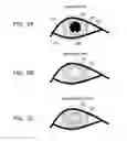Fig. 04 - Line-of-sight detection method and device