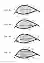 Fig. 09 - Line-of-sight detection method and device