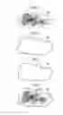 Fig. 03 - Image alignment device, method, and program