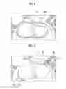 Fig. 05 - Image alignment device, method, and program