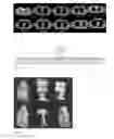 Fig. 17 - Applications of automatic anatomy recognition in medical tomographic imagery based on fuzzy anatomy models