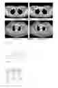 Fig. 18 - Applications of automatic anatomy recognition in medical tomographic imagery based on fuzzy anatomy models