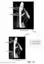 Fig. 05 - Robust feature identification for image-based object recognition