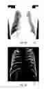 Fig. 03 - Visualization of projection X-ray image