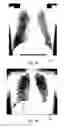 Fig. 04 - Visualization of projection X-ray image