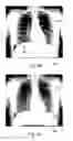 Fig. 05 - Visualization of projection X-ray image