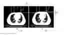 Fig. 01 - Method and system for determining a respiratory phase