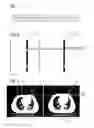 Fig. 02 - Method and system for determining a respiratory phase