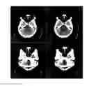 Fig. 01 - Apparatus and method for beam hardening artifact correction of CT image