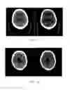 Fig. 07 - Apparatus and method for beam hardening artifact correction of CT image