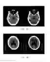 Fig. 08 - Apparatus and method for beam hardening artifact correction of CT image