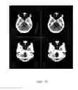 Fig. 09 - Apparatus and method for beam hardening artifact correction of CT image