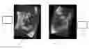Fig. 01 - Acquisition-orientation-dependent features for model-based segmentation of ultrasound images