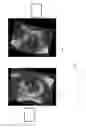 Fig. 04 - Acquisition-orientation-dependent features for model-based segmentation of ultrasound images