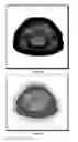 Fig. 09 - Method for the automatic segmentation and quantification of body tissues