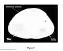 Fig. 14 - Method for the automatic segmentation and quantification of body tissues