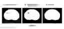 Fig. 15 - Method for the automatic segmentation and quantification of body tissues