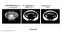 Fig. 16 - Method for the automatic segmentation and quantification of body tissues