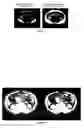 Fig. 18 - Method for the automatic segmentation and quantification of body tissues