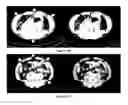 Fig. 19 - Method for the automatic segmentation and quantification of body tissues