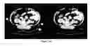 Fig. 20 - Method for the automatic segmentation and quantification of body tissues