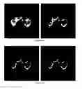 Fig. 22 - Method for the automatic segmentation and quantification of body tissues