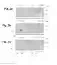Fig. 03 - Method for detecting interferences in a crop collection system