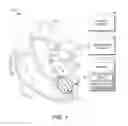 Fig. 02 - ADJUSTABLE DEPTH ANATOMICAL SHELL EDITING