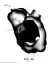 Fig. 06 - ADJUSTABLE DEPTH ANATOMICAL SHELL EDITING