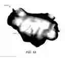 Fig. 07 - ADJUSTABLE DEPTH ANATOMICAL SHELL EDITING