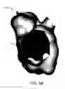 Fig. 08 - ADJUSTABLE DEPTH ANATOMICAL SHELL EDITING