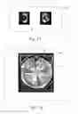 Fig. 11 - GAMING SYSTEM AND A METHOD OF GAMING