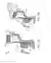 Fig. 06 - Modular trigger assembly