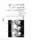 Fig. 10 - Method for manufacturing a semiconductor material including a semi-polar III-nitride layer