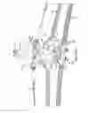 Fig. 03 - Tangent suspension accessory assembly and accessory bracket therefor