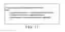 Fig. 10 - Impedance matching circuit and method for radio frequency transmission coil