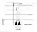 Fig. 99 - OPTICAL SUBCHANNEL ROUTING, PROTECTION SWITCHING AND SECURITY