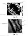 Fig. 07 - Stiffening plate for acoustic membrane and method of manufacturing same