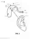 Fig. 03 - Listening device with automatic mode change capabilities