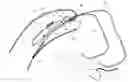 Fig. 01 - Hearing device comprising an electric cable