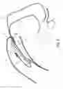 Fig. 03 - Hearing device comprising an electric cable