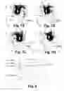 Fig. 07 - Hearing device