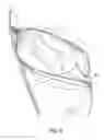 Fig. 09 - LEASH WITH COLLAPSIBLE POCKETS