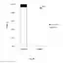 Fig. 49 - ANIMAL MODELS AND THERAPEUTIC MOLECULES