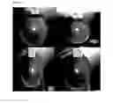 Fig. 02 - Disinfectant formulation comprising calcium hydroxide and sodium hypochlorite