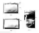Fig. 05 - PERSONAL PROTECTIVE EQUIPMENT AND METHODS
