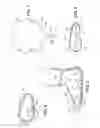 Fig. 04 - Footwear device